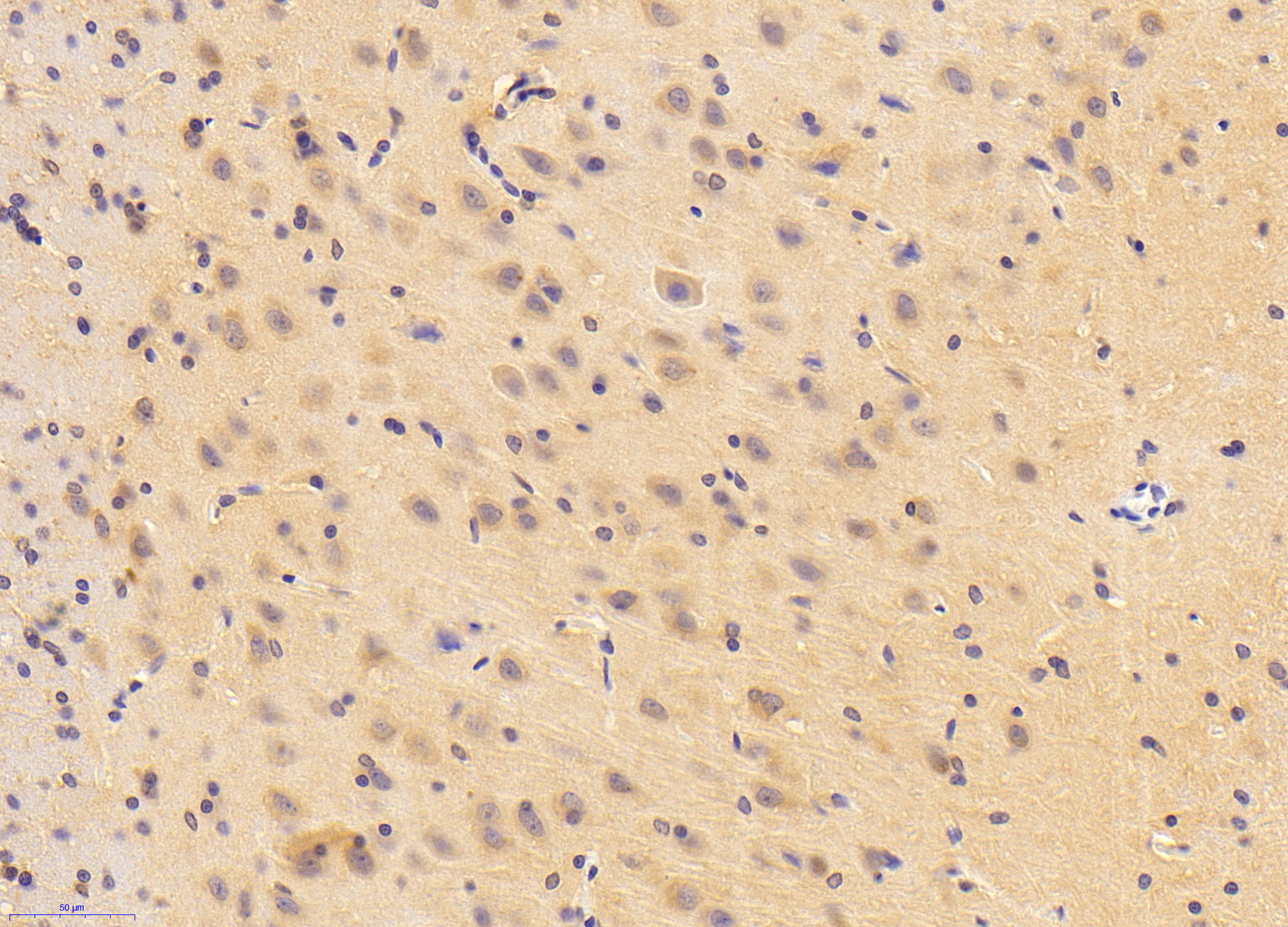 Biotin-Linked Polyclonal Antibody to Protein Kinase C Gamma (PKCg)