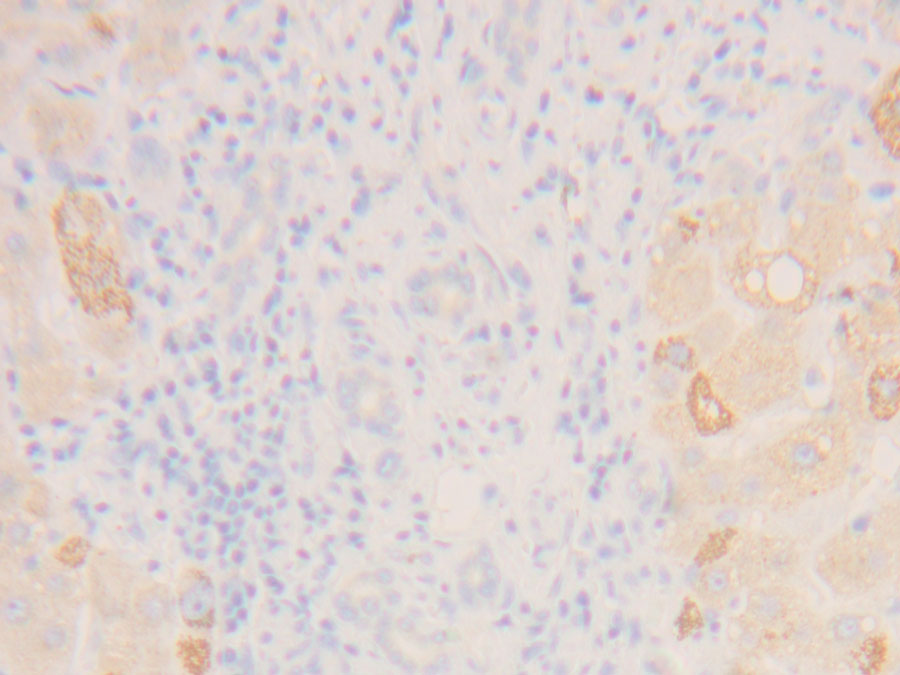 Biotin-Linked Polyclonal Antibody to Inhibin Beta C (INHbC)