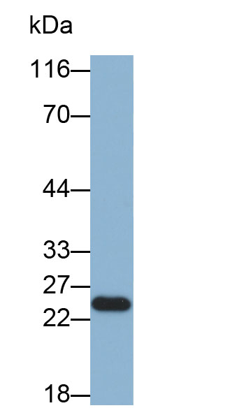 Biotin-Linked Polyclonal Antibody to Cardiac Troponin I (cTnI)