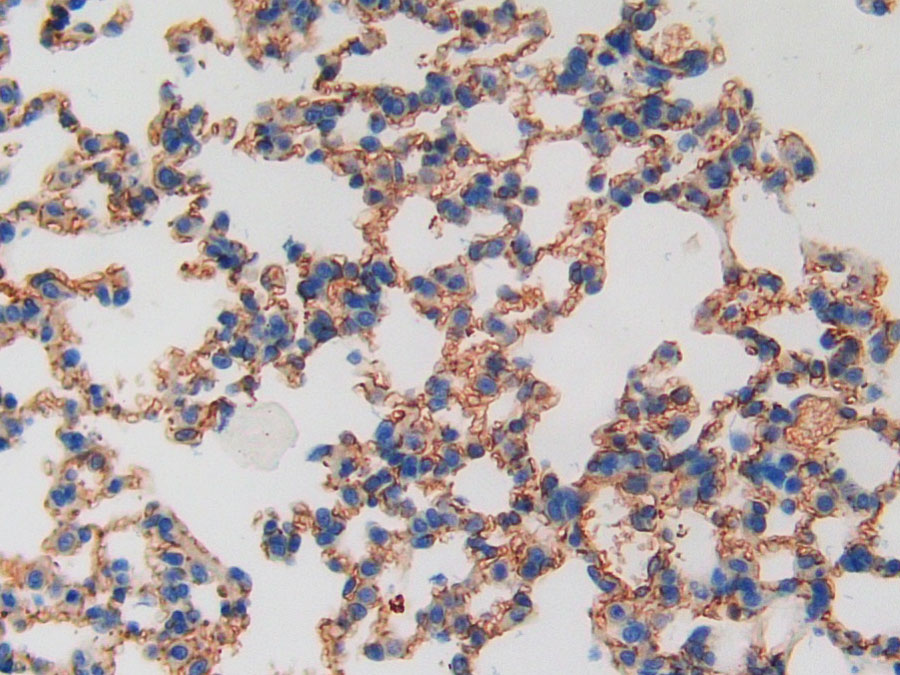 Biotin-Linked Polyclonal Antibody to Thrombomodulin (TM)