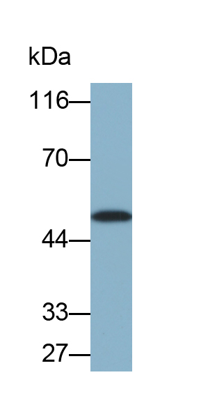 Cy3-Linked Polyclonal Antibody to Cytokeratin 7 (CK7)