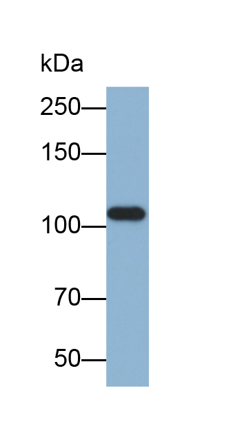 Biotin-Linked Polyclonal Antibody to Thyroid Peroxidase (TPO)