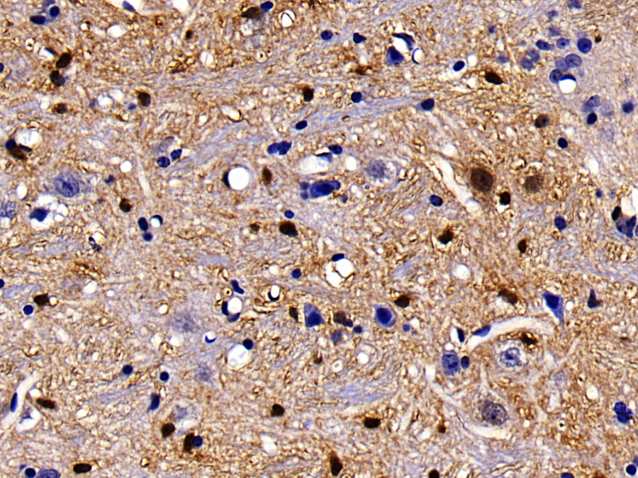 Biotin-Linked Polyclonal Antibody to S100 Calcium Binding Protein B (S100B)