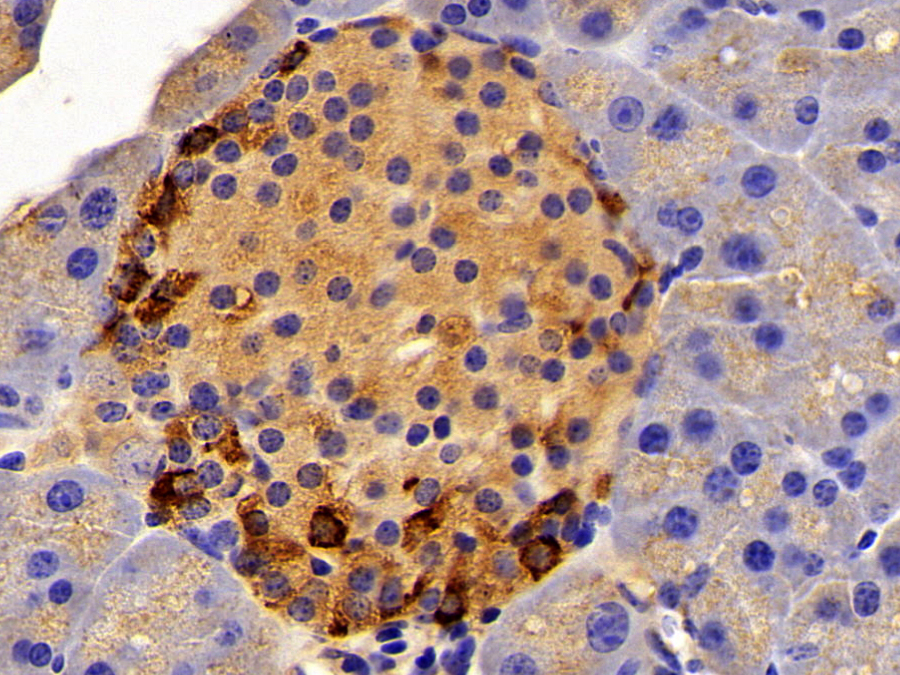 Biotin-Linked Polyclonal Antibody to Somatostatin (SST)