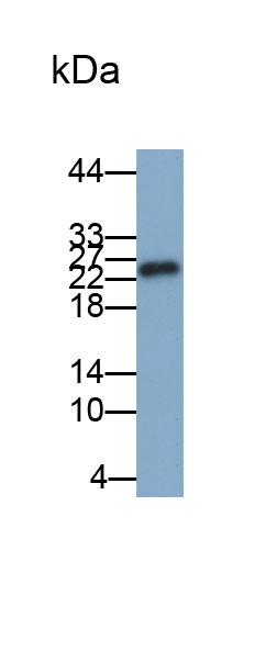 Biotin-Linked Polyclonal Antibody to Glutathione S Transferase Mu 1 (GSTM1)