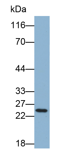 Biotin-Linked Polyclonal Antibody to Glutathione S Transferase Mu 1 (GSTM1)