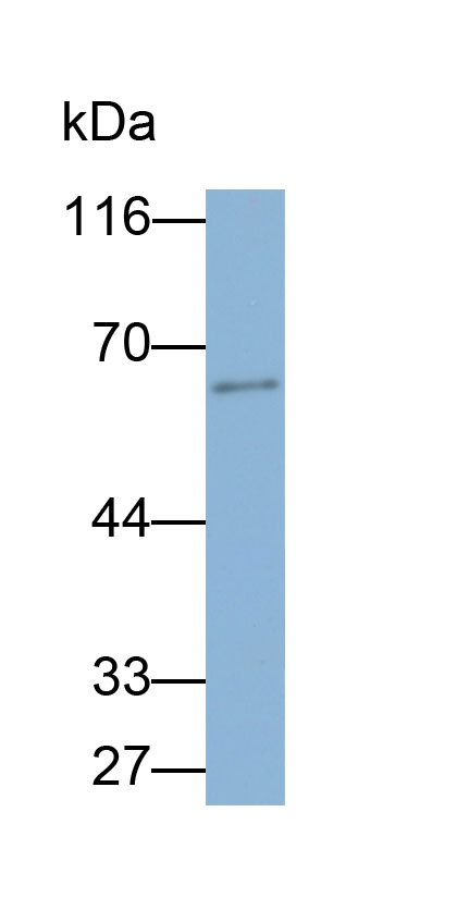 Biotin-Linked Polyclonal Antibody to Lipase, Hepatic (LIPC)