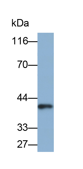 Biotin-Linked Polyclonal Antibody to Alpha-1-Acid Glycoprotein (a1AGP)