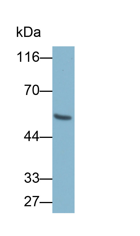 Biotin-Linked Polyclonal Antibody to Alpha-1-Acid Glycoprotein (a1AGP)