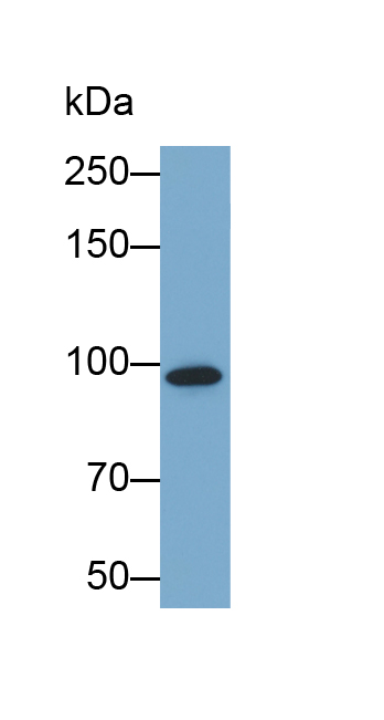 Biotin-Linked Polyclonal Antibody to Glycogen Phosphorylase, Muscle (PYGM)