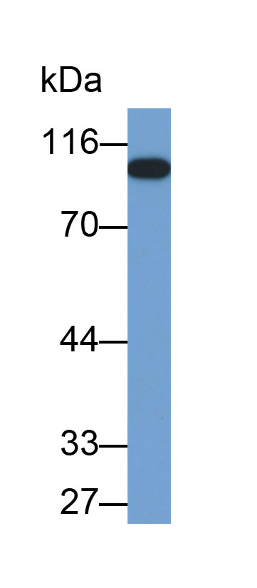 Biotin-Linked Polyclonal Antibody to Glycogen Phosphorylase, Liver (PYGL)