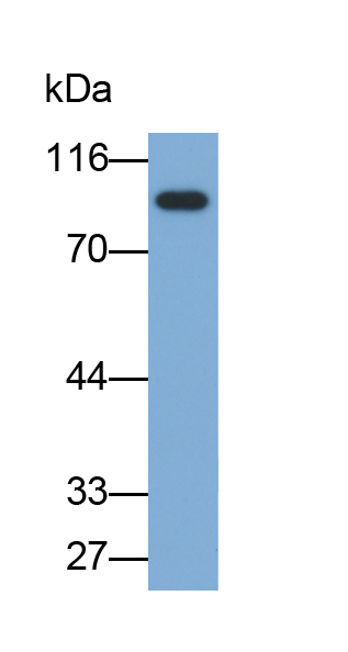 Biotin-Linked Polyclonal Antibody to Glycogen Phosphorylase, Liver (PYGL)