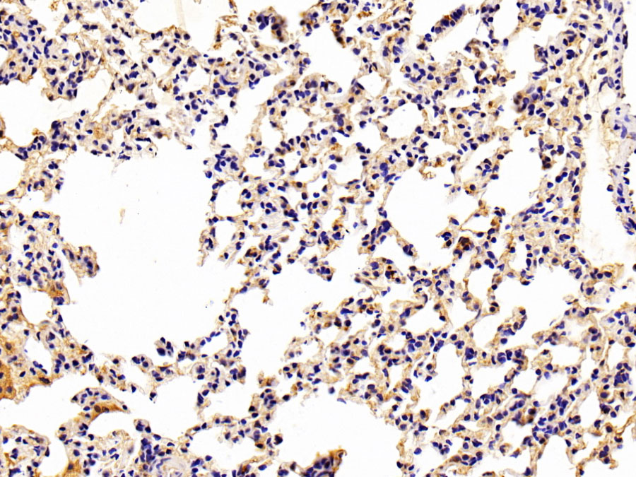 Biotin-Linked Polyclonal Antibody to Arachidonate-15-Lipoxygenase (ALOX15)