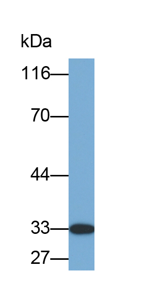 Biotin-Linked Polyclonal Antibody to Acid Phosphatase 5, Tartrate Resistant (ACP5)