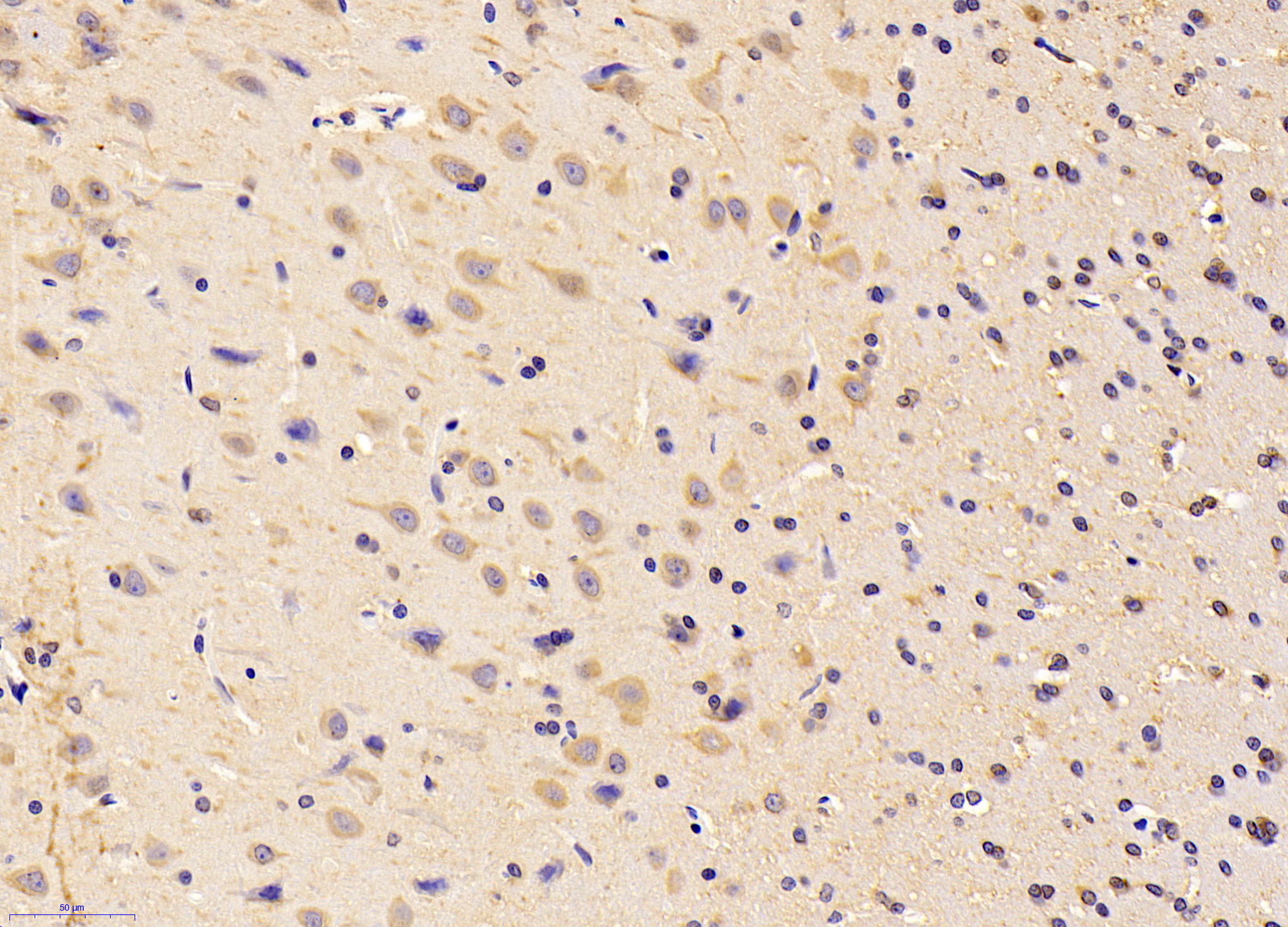 HRP-Linked Polyclonal Antibody to Chemerin (CHEM)