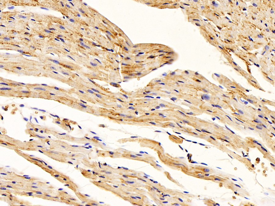 Biotin-Linked Polyclonal Antibody to Activin A Receptor Type I (ACVR1)