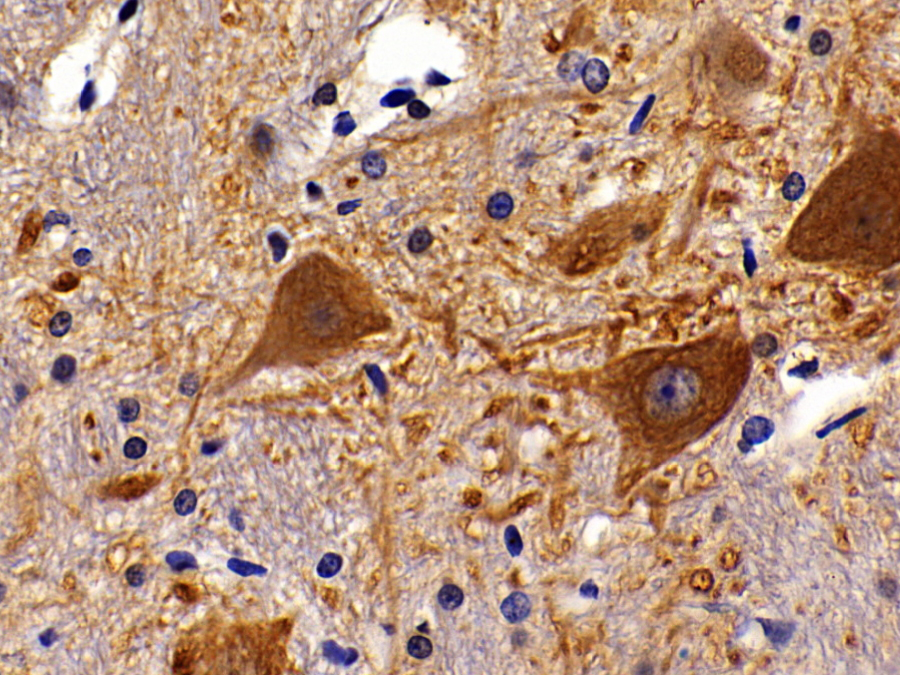 Biotin-Linked Polyclonal Antibody to Cholinergic Receptor, Muscarinic 1 (CHRM1)