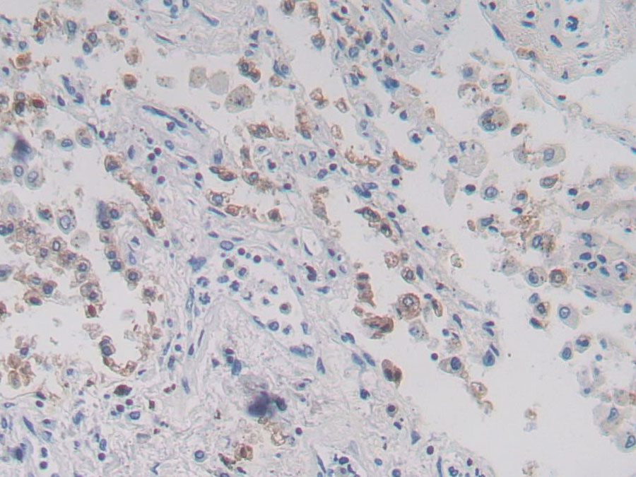 Biotin-Linked Polyclonal Antibody to Surfactant Associated Protein D (SPD)