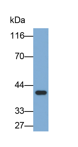 Biotin-Linked Polyclonal Antibody to Aspartate Aminotransferase (AST)