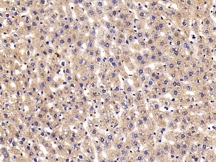 Biotin-Linked Polyclonal Antibody to Corticosteroid Binding Globulin (CBG)