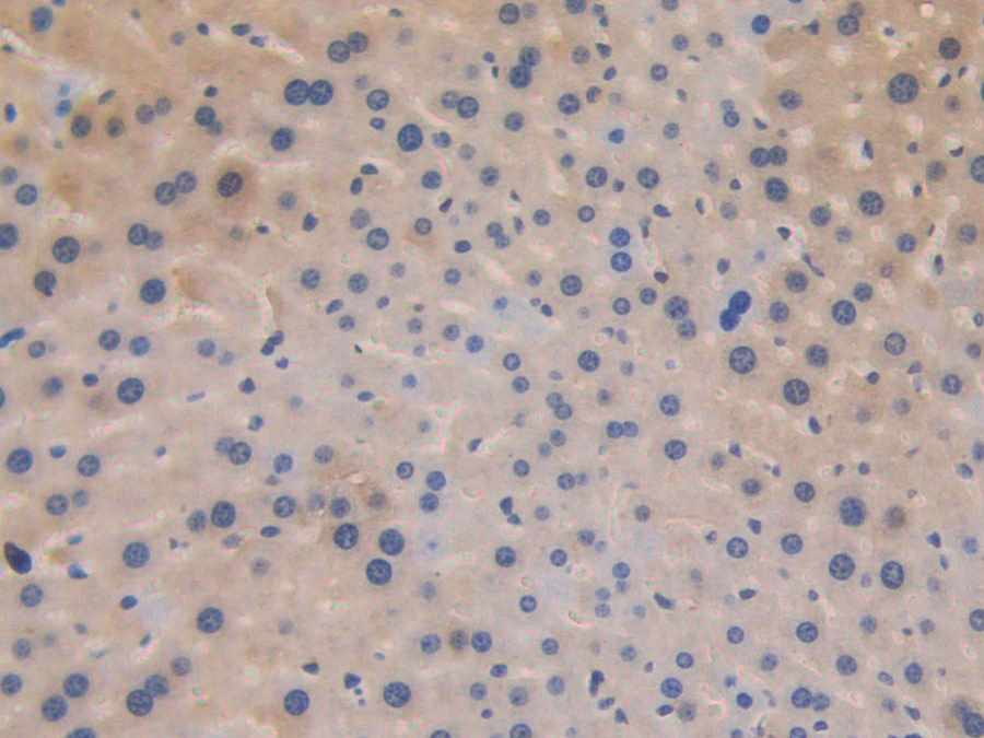 Biotin-Linked Polyclonal Antibody to Corticosteroid Binding Globulin (CBG)