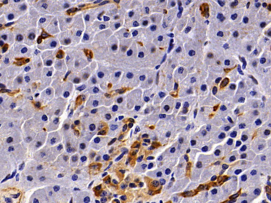 Biotin-Linked Polyclonal Antibody to Cytokeratin 19 (CK19)