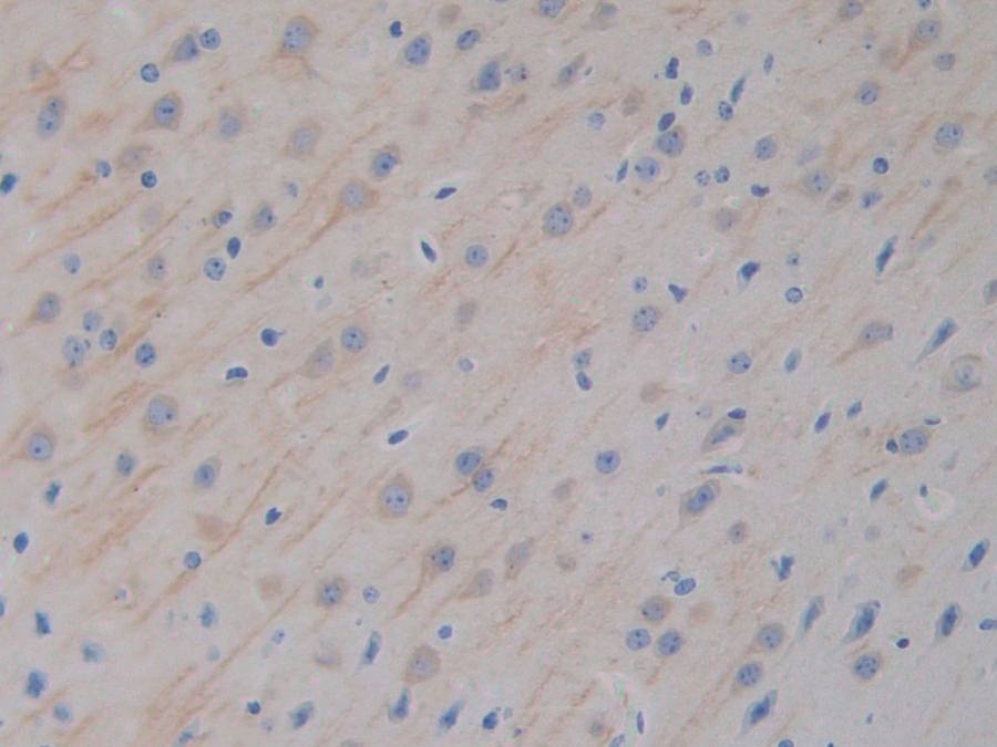 Biotin-Linked Polyclonal Antibody to Microtubule Associated Protein 2 (MAP2)