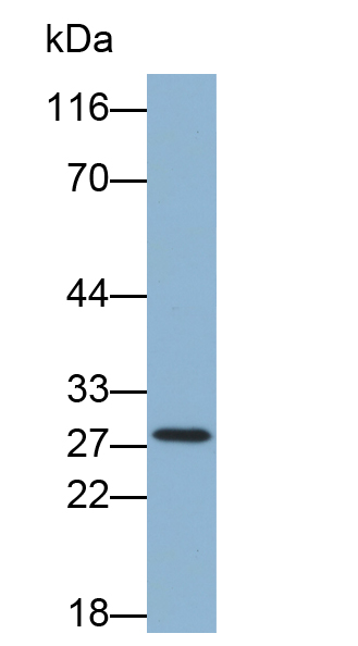 Biotin-Linked Polyclonal Antibody to Proteinase 3 (PR3)