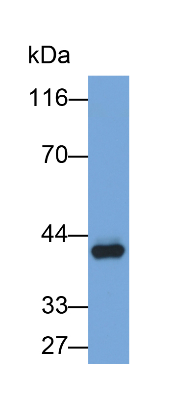 Biotin-Linked Polyclonal Antibody to Interleukin 2 Receptor Gamma (IL2Rg)