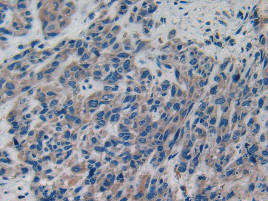 Biotin-Linked Polyclonal Antibody to Cytosolic Phospholipase A2 (PLA2G4)