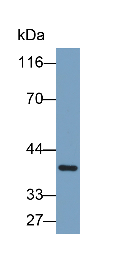 Biotin-Linked Polyclonal Antibody to Interleukin 13 Receptor Alpha 2 (IL13Ra2)