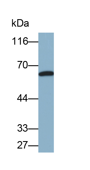 Biotin-Linked Polyclonal Antibody to Interleukin-18 Receptor Beta (IL18R Beta)