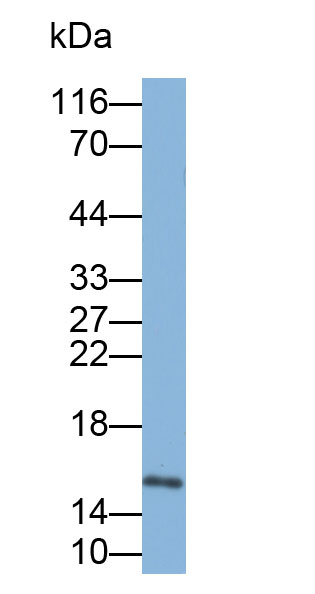 Biotin-Linked Polyclonal Antibody to Fatty Acid Binding Protein 4 (FABP4)