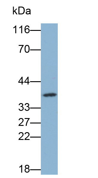 Biotin-Linked Polyclonal Antibody to Lactate Dehydrogenase B (LDHB)