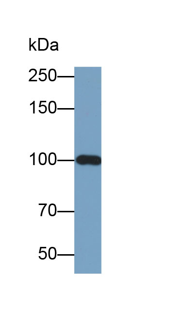 Biotin-Linked Polyclonal Antibody to A Disintegrin And Metalloproteinase With Thrombospondin 1 (ADAMTS1)