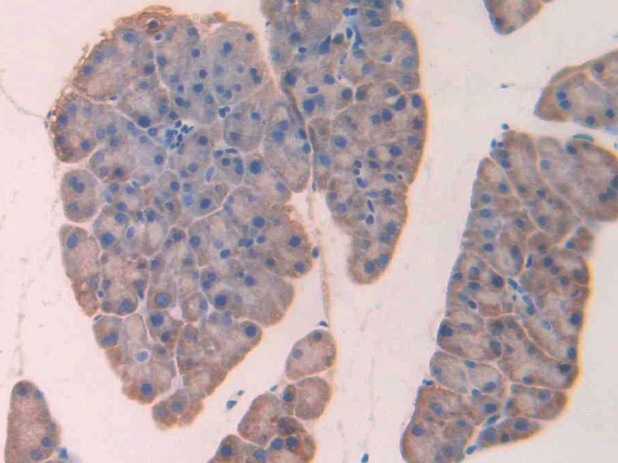 Biotin-Linked Polyclonal Antibody to Lysyl Oxidase (LOX)