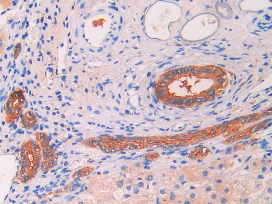 Biotin-Linked Polyclonal Antibody to Mitochondrial Uncoupling Protein 2 (UCP2)