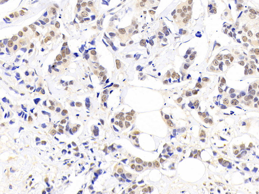 Biotin-Linked Polyclonal Antibody to Nucleophosmin 1 (NPM1)