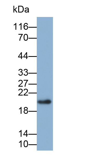 Biotin-Linked Polyclonal Antibody to Ferritin, Heavy Polypeptide (FTH)