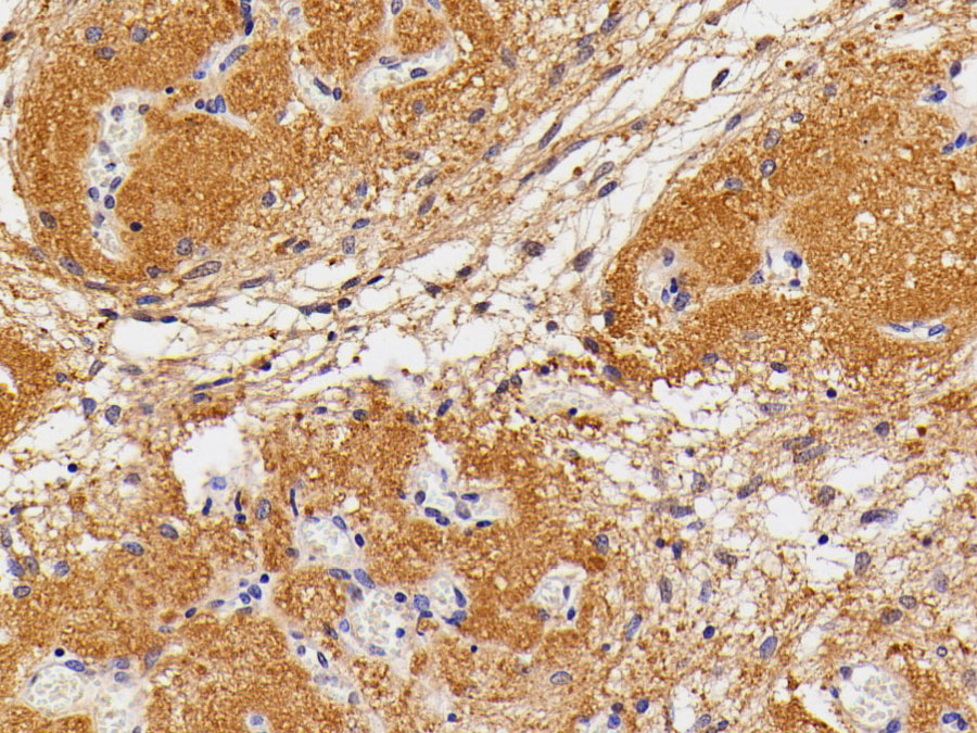 Biotin-Linked Polyclonal Antibody to Thyroid Stimulating Hormone Beta (TSHb)