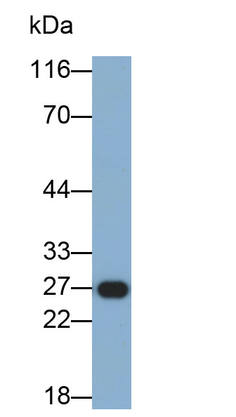 Biotin-Linked Polyclonal Antibody to Troponin I Type 1, Slow Skeletal (TNNI1)