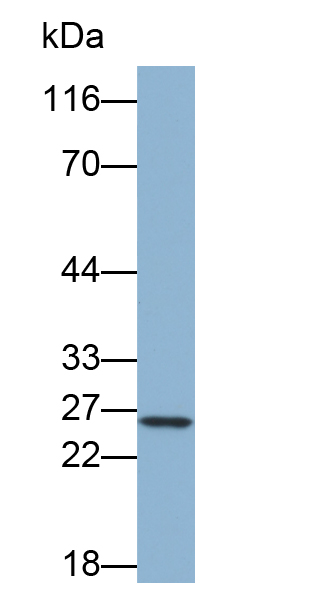 Biotin-Linked Polyclonal Antibody to Troponin I Type 1, Slow Skeletal (TNNI1)