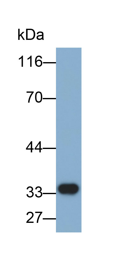 Biotin-Linked Polyclonal Antibody to Troponin T Type 1, Slow Skeletal (TNNT1)