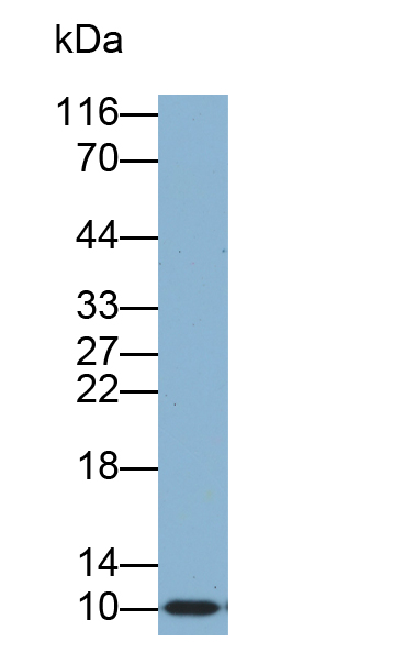 Biotin-Linked Polyclonal Antibody to Diazepam Binding Inhibitor (DBI)