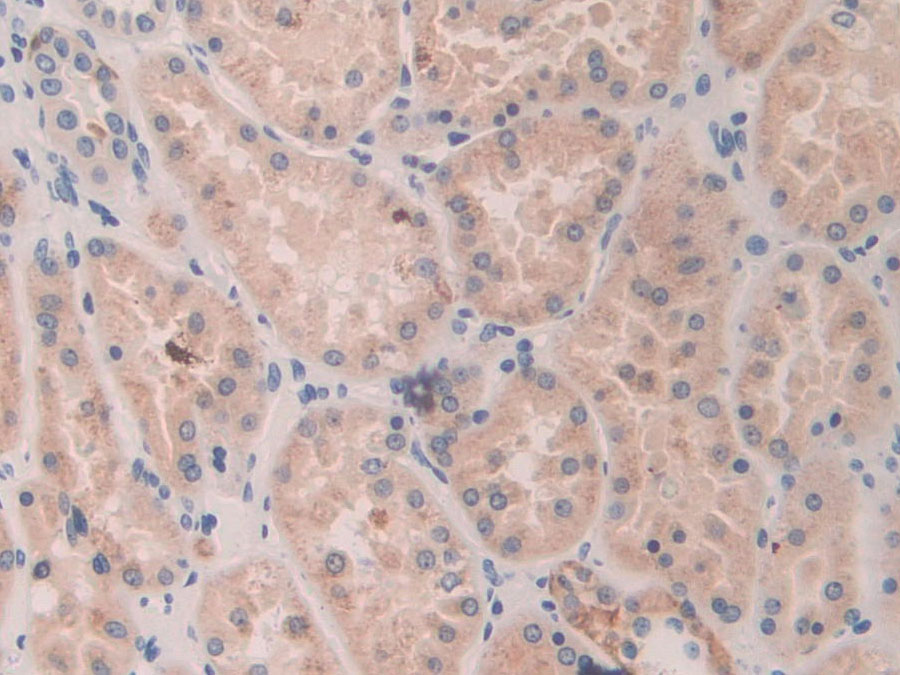 Biotin-Linked Polyclonal Antibody to Killer Cell Immunoglobulin Like Receptor 2DL3 (KIR2DL3)