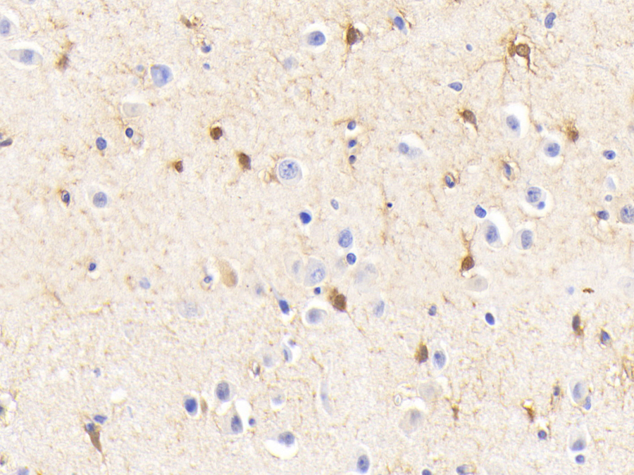 Biotin-Linked Polyclonal Antibody to Glutamine synthetase (GS)