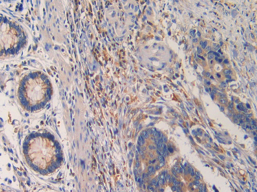 Biotin-Linked Polyclonal Antibody to Proprotein Convertase Subtilisin/Kexin Type 9 (PCSK9)