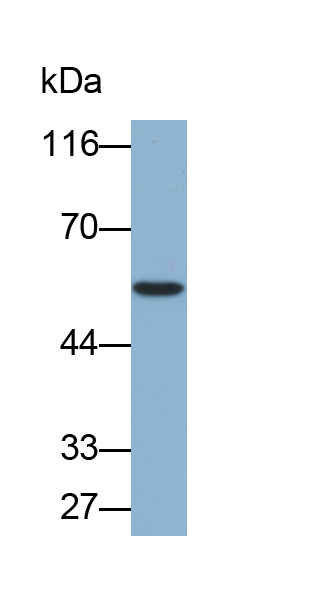 Biotin-Linked Polyclonal Antibody to Aldehyde Dehydrogenase 7 Family, Member A1 (ALDH7A1)