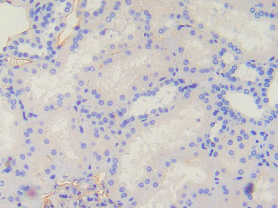 Biotin-Linked Polyclonal Antibody to Secreted Frizzled Related Protein 1 (SFRP1)