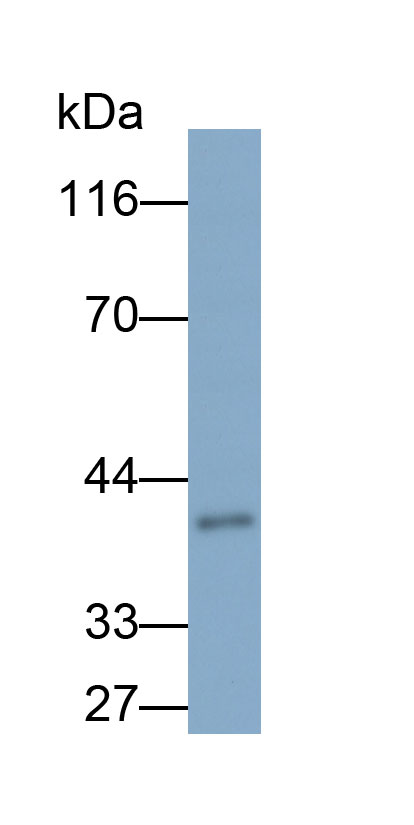 Biotin-Linked Polyclonal Antibody to Hepatocellular Carcinoma Related Protein 1 (HCRP1)